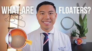 What are Floaters? Explained by an MD