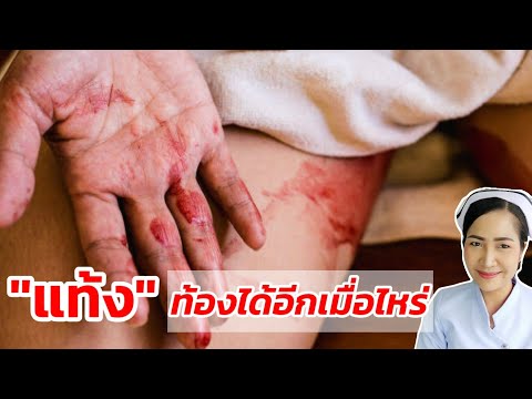 วีดีโอ: วิธีการขูดขีดคันเจ็ดปีและเปลี่ยนความสัมพันธ์ของคุณใหม่