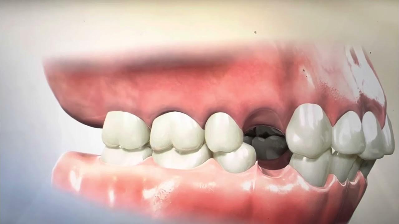 Why Do My Braces Change Color