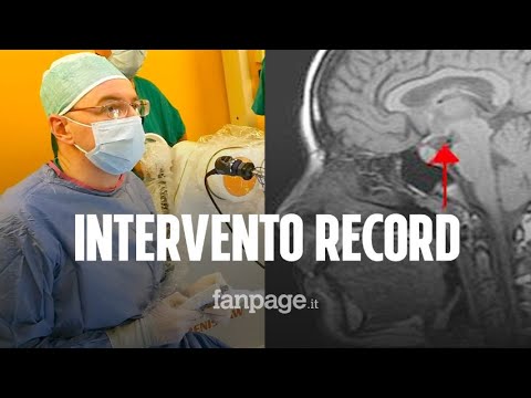 Video: Il Bambino è Nato Con Un Cranio Aperto E Deformato Ed è Ancora Vivo - Visualizzazione Alternativa