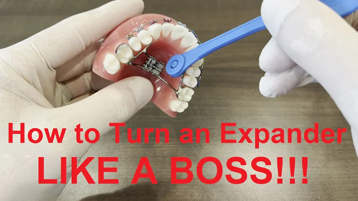 How to Turn an Expander