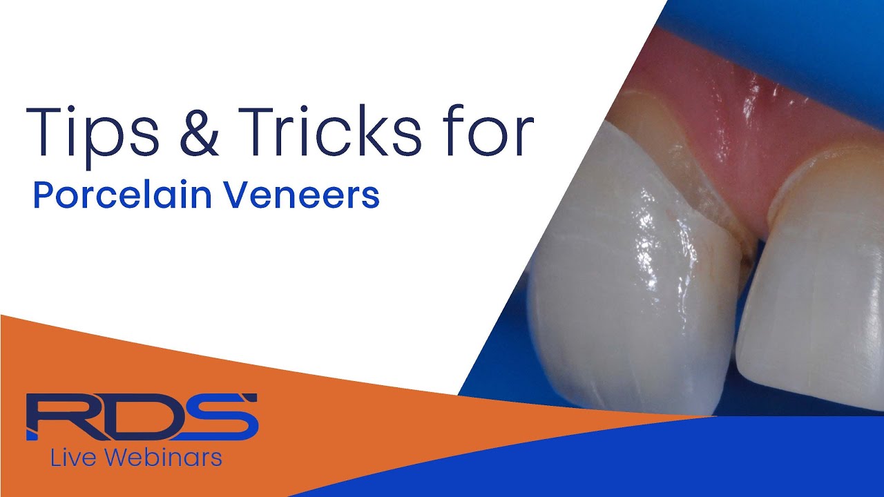 Tips and tricks porcelain veneers