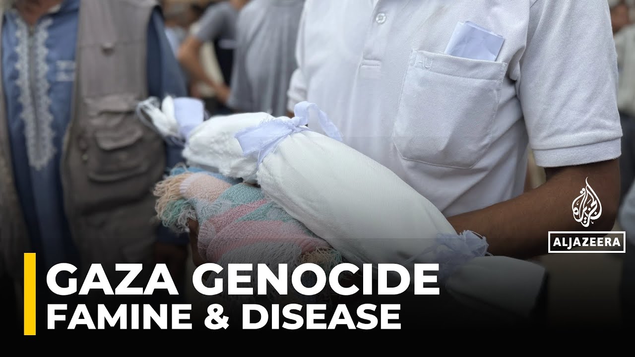 المجاعة في غزة لا تقتصر على الطعام فحسب، بل تشمل الماء والمرض واليأس: طبيب من غزة