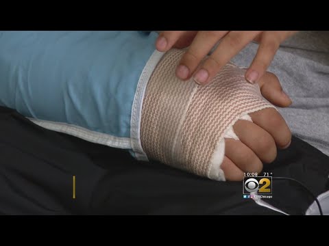 Video: VPI Veröffentlicht Top Ten Broken Bone Claims Für „o8“