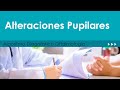 Alteraciones Pupilares. Algoritmo Diagnóstico Oftalmología