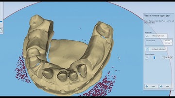 How to perform intelligent add scan Shining3d DS-EX / DS-EX Pro S / MIX