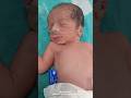Preterm baby &amp; Wt 1kg#new born baby