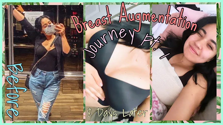 Breast Augmentation Journey pt. 1 | Mitzi Flores