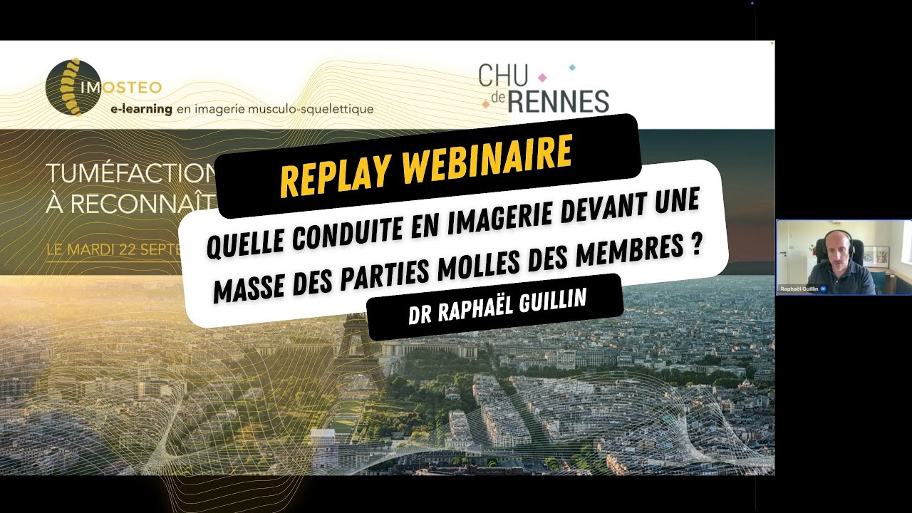 Replay webinaire - Quelle conduite en imagerie devant une masse des parties molles des membres ?