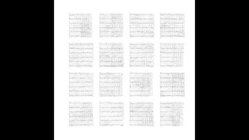 ECG image generation using generative adversarial neural networks (GAN)