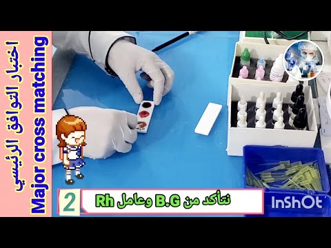 اختبار تطابق Cross Matching نقل الدم وأنواع التوافق Yousiftubelab2094