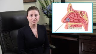 Nasal Cautery - A procedure to stop nose bleeding