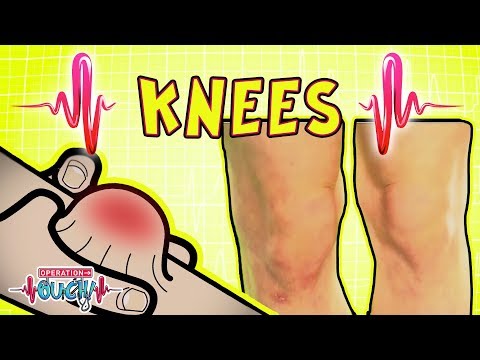 Knobbly Knees