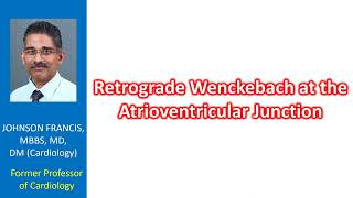 Retrograde Wenckebach at the Atrioventricular Junction