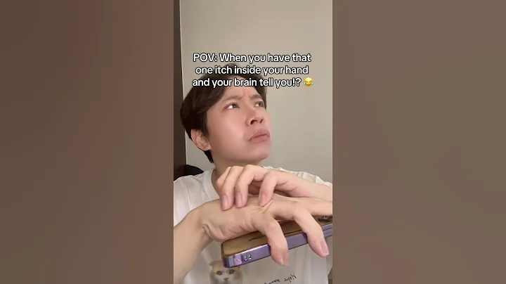 THAT ONE Hand Itch Moment 😂 #shorts