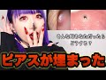 【衝撃】ピアスが埋まった時あなたならどう対処しますか？