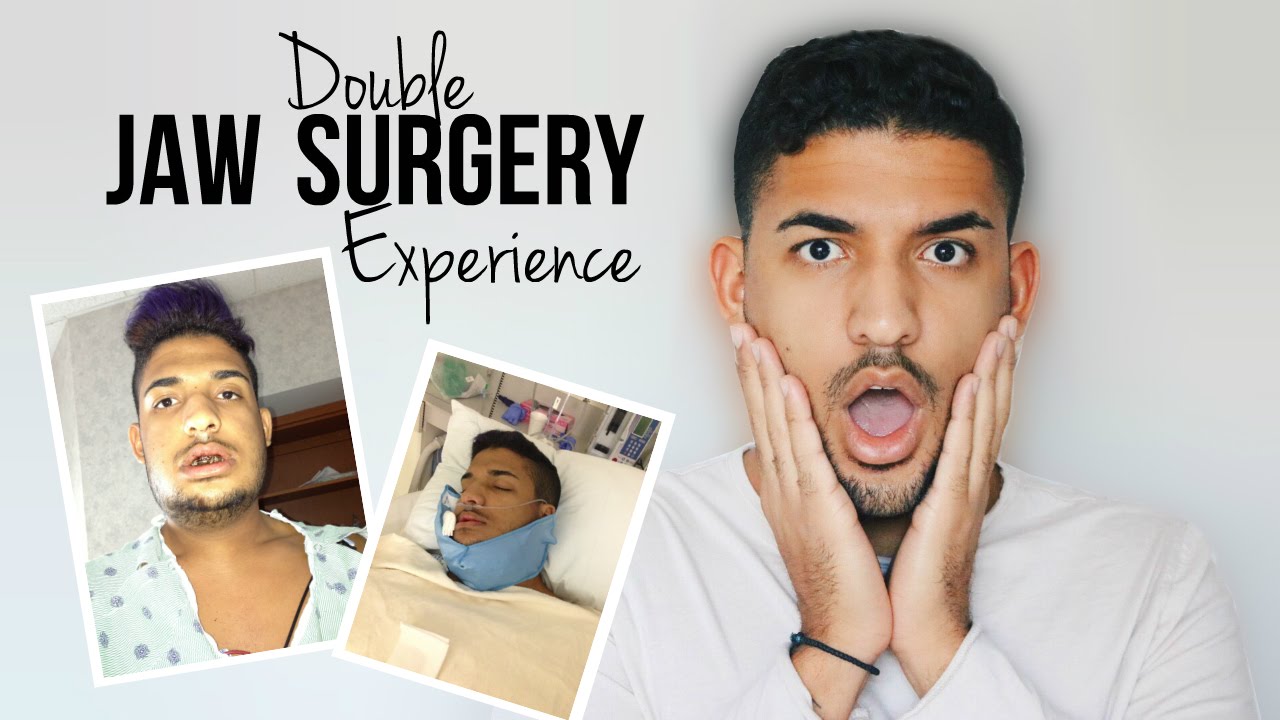 STORY TIME MY DOUBLE JAW SURGERY EXPERIENCE DemTheCeleb YouTube
