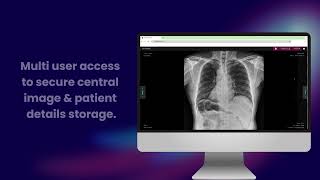 iTX Cloud PACS