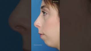 Why Are Faces Becoming Less Attractive? The Shocking Truth!