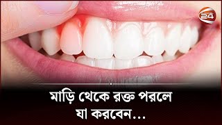 মাড়ি ফুলে যাচ্ছে বা মাড়ি থেকে রক্ত পরছে? কি করবেন? | Oral Gum Infection | Oral Health | Channel 24 screenshot 2