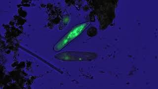 Freshwater ciliates stained acridine orange