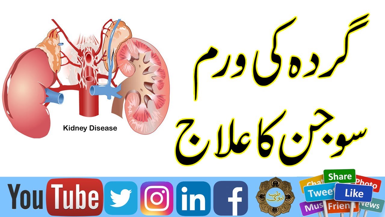 Gurdy Ki Sozish Or Warm Ka Ilaj Treatment Of Kidney And Stone gurdy-ki-sozish-or-warm-ka-ilaj-treatment-of-kidney-and-stone