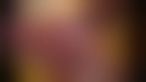 Laparoscopic Cholecystectomy using KARL STORZ IMAGE1 S™ Rubina NIR/ICG Technology