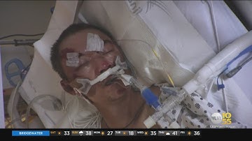 Asian Man Victim Of Hate Crime Dies From His Injuries