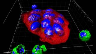 Moffitt Cancer Center - Clinical Trials