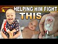 2 Years Old &amp; Fighting for His Life.... AGAIN ❗️HELP ME HELP ARTHUR