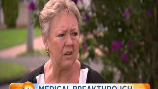 Mazor Robotics Renaissance Spine Surgery in Australia: Channel 9 & TODAY