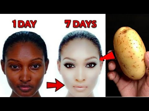 Potato cream to whiten face and dark areas 10 shades instantly