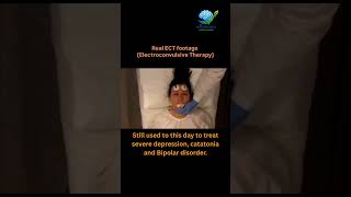 ⚡ The Truth About ECT: Psychiatry's Most Misunderstood Treatment 🧠