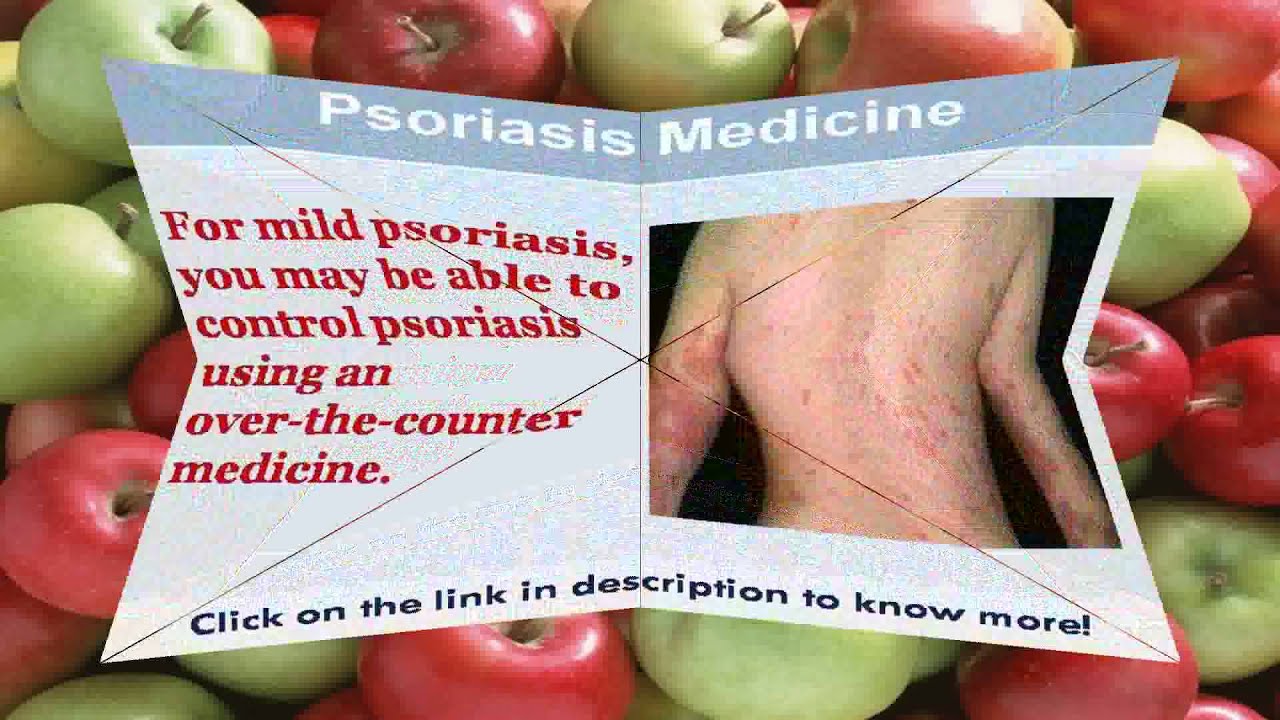 See now what is the best medicine for psoriasis YouTube