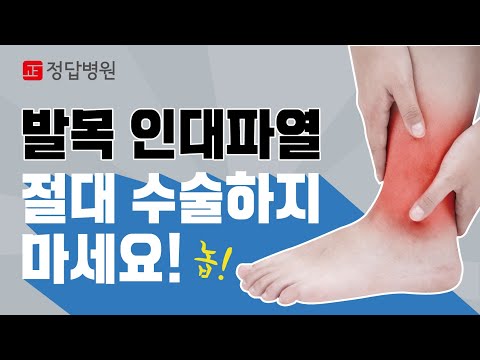 발목인대파열, 수술없이 낫는 방법 수원정형외과