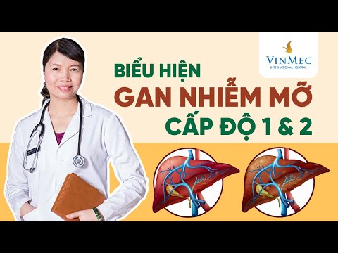 Đặc điểm gan nhiễm mỡ cấp độ 1 và 2 | BS Trần Thị Phương Thúy, Vinmec Times City (Hà Nội)