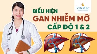 Biểu hiện gan nhiễm mỡ cấp độ 1 và 2 | BS Trần Thị Phương Thúy, Vinmec Times City (Hà Nội)