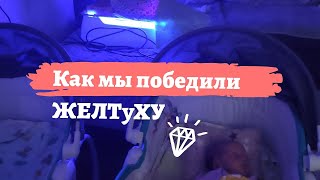 Желтуха у новорожденных. Один из способов вылечить желтушку.