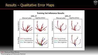 Deep Learning Segmentation of Lenticulostriate Arteries Using 3T and 7T 3D Black-Blood MRI