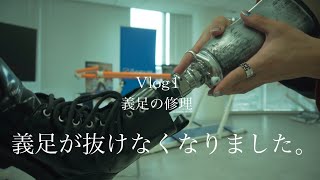 『絶望』義足が抜けなくなってしまったので修理に行く。~Vlog.1~