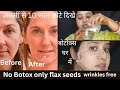 अलसी से पाए झुर्रियों से छुटकारा !#skincare at home ll#tutorial