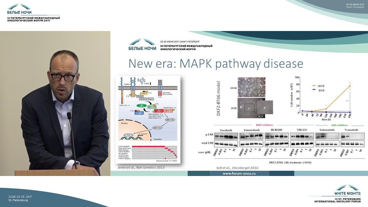LOGGIC Europe: планирующийся протокол SIOPE для лечения глиом низкой степени злокачественности