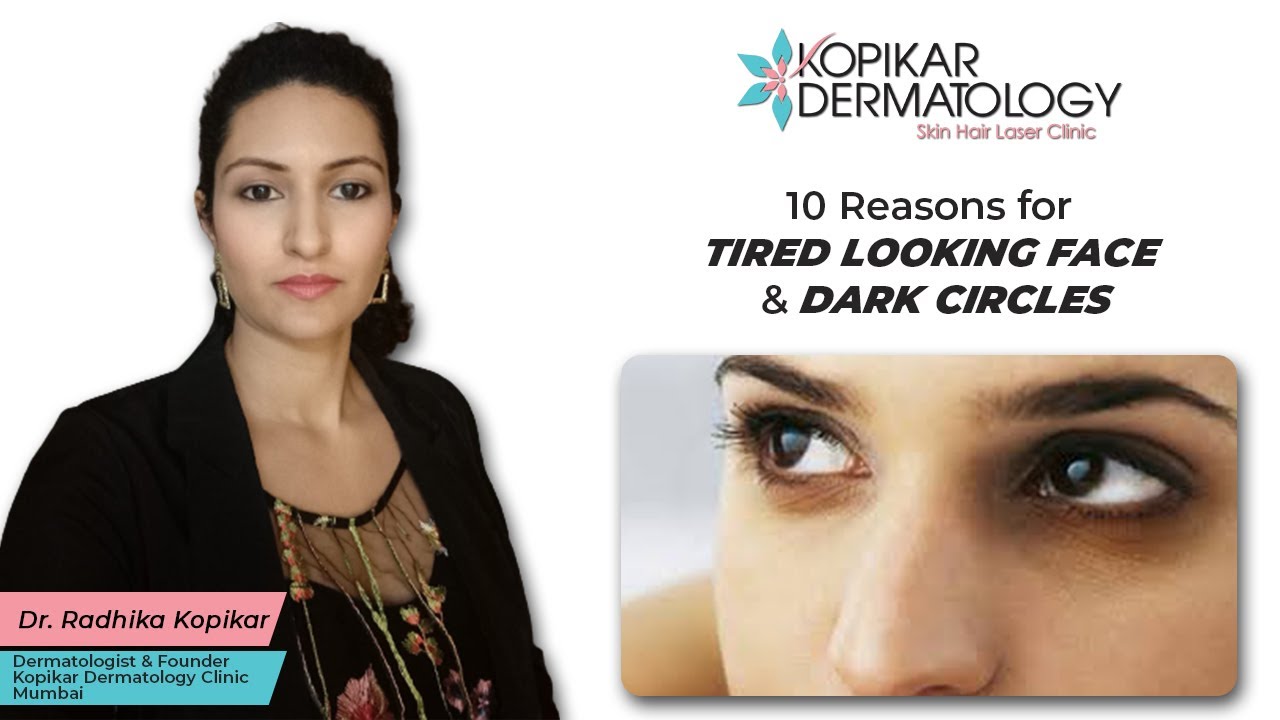 Reasons for Tired Looking Face | Dark Circles | Kopikar Dermatology