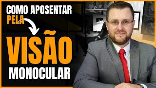Download Lagu QUEM SE ENQUADRA NA APOSENTADORIA POR VISÃO MONOCULAR? MP3 Download Lagu QUEM SE ENQUADRA NA APOSENTADORIA POR VISÃO MONOCULAR? MP3