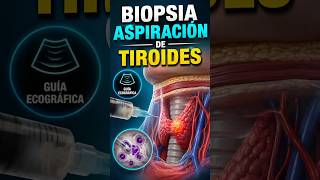 ¿TIENE INDICACIÓN DE UNA BIOPSIA ASPIRACIÓN DE TIROIDES? ¿CÓMO SE REALIZA? #tiroides