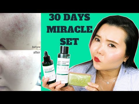 SỬ DỤNG SET TRỊ MỤN THẦN THÁNH TRONG 7 NGÀY VÀ CÁI KẾT // 30 DAYS MIRACLE SERUM-TONER-CLEANSER