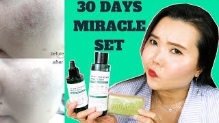 SỬ DỤNG SET TRỊ MỤN THẦN THÁNH TRONG 7 NGÀY VÀ CÁI KẾT // 30 DAYS MIRACLE SERUM-TONER-CLEANSER