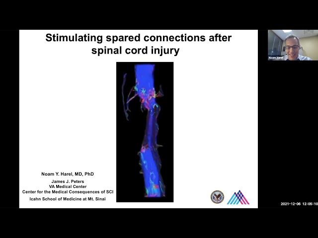 Stimulating Spared Connections After Spinal Cord Injury