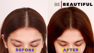 बालों में Volume कैसे लाएं? | How To Care For Your Scanty Hair | Be Beautiful