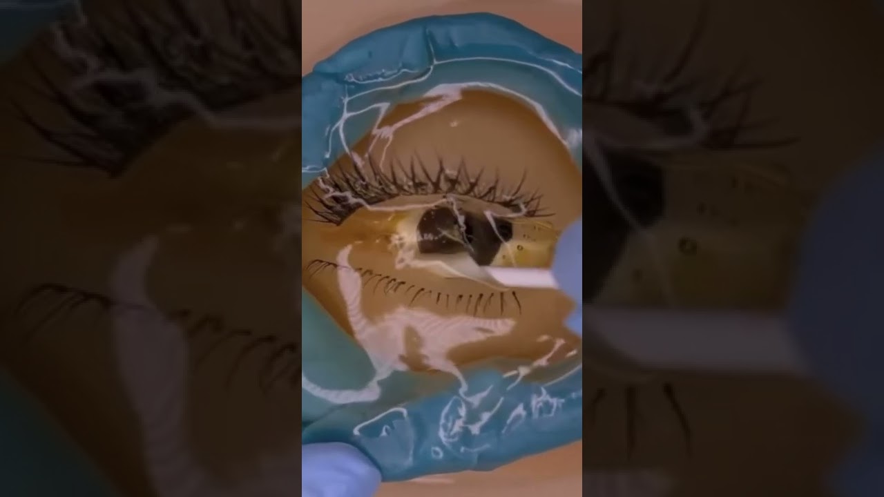 Indian Eye Butter Treatment 😂😂😂 | ASMR Funny Video 